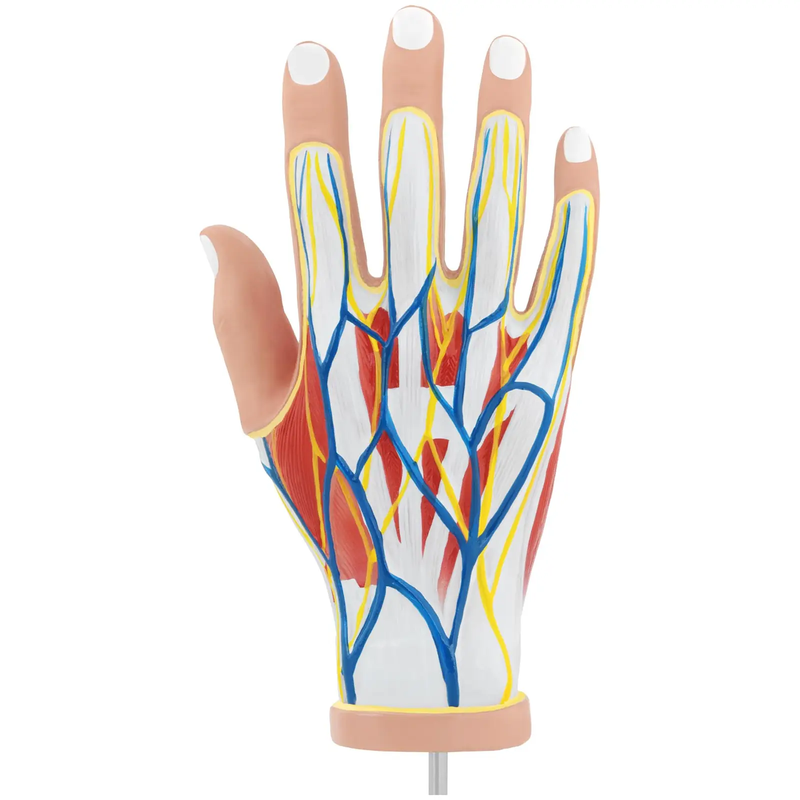 Modello anatomico mano con degenerazione muscolare - 4 parti - A grandezza naturale